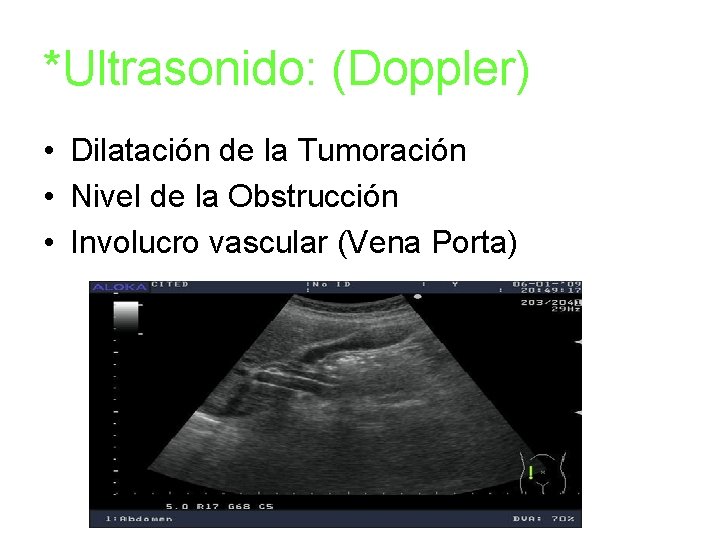 *Ultrasonido: (Doppler) • Dilatación de la Tumoración • Nivel de la Obstrucción • Involucro