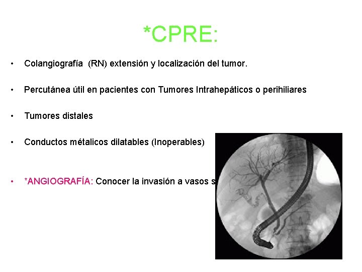 *CPRE: • Colangiografía (RN) extensión y localización del tumor. • Percutánea útil en pacientes