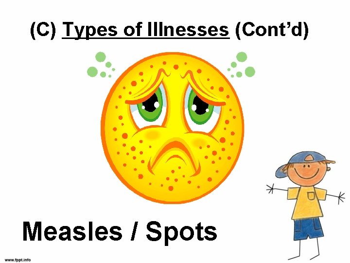 (C) Types of Illnesses (Cont’d) Measles / Spots 