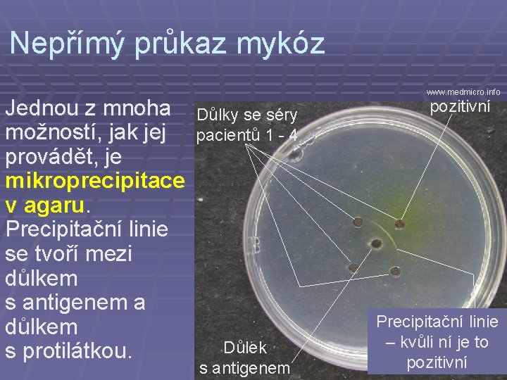 Nepřímý průkaz mykóz Jednou z mnoha možností, jak jej provádět, je mikroprecipitace v agaru.