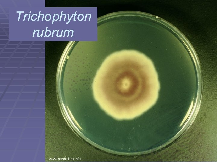 Trichophyton rubrum www. medmicro. info 