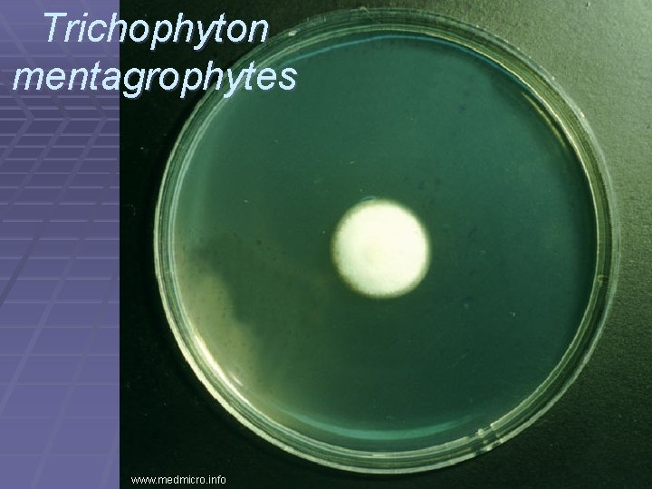Trichophyton mentagrophytes www. medmicro. info 