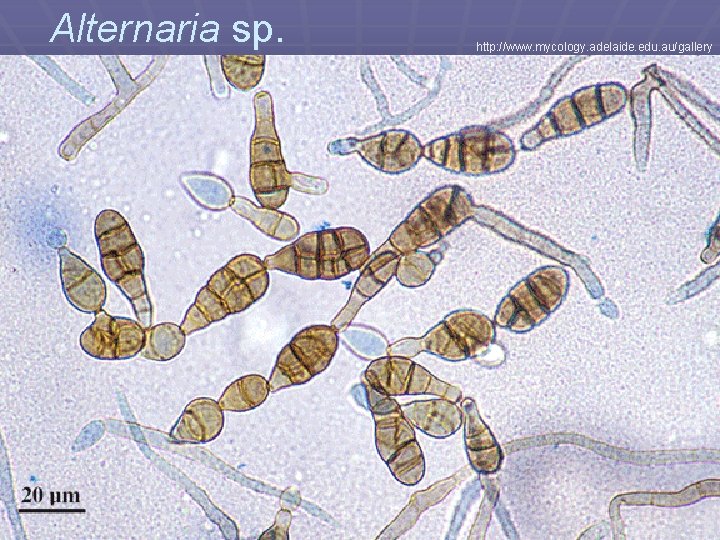 Alternaria sp. http: //www. mycology. adelaide. edu. au/gallery 