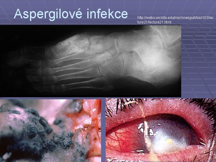 Aspergilové infekce http: //webs. wichita. edu/mschneegurt/biol 103/lec ture 21/lecture 21. html 