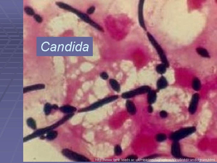 Candida http: //www. bmb. leeds. ac. uk/mbiology/ug/ugteach/icu 8/std/candidgram. html 