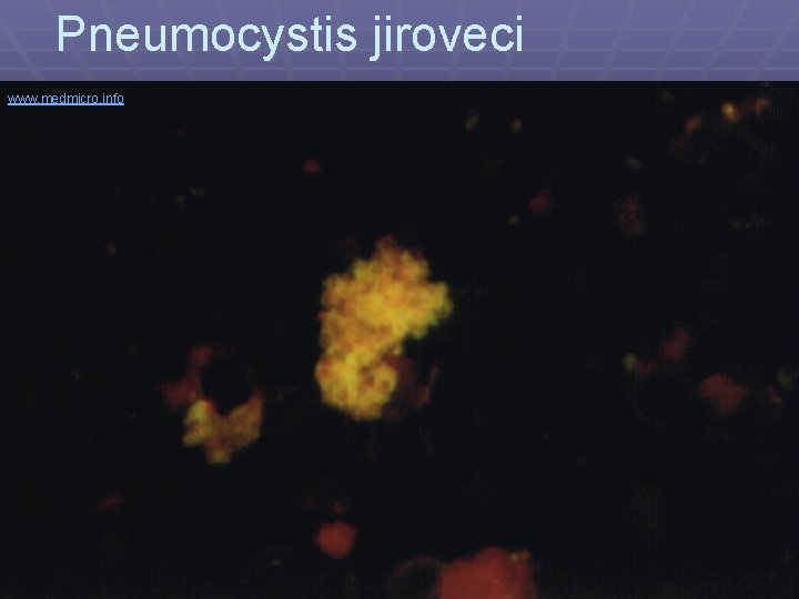 Pneumocystis jiroveci www. medmicro. info 