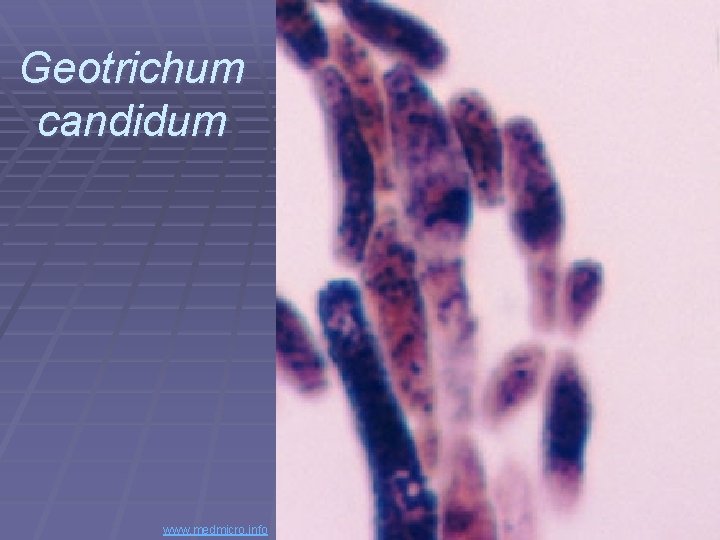 Geotrichum candidum www. medmicro. info 