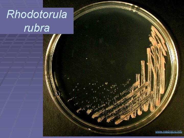 Rhodotorula rubra www. medmicro. info 
