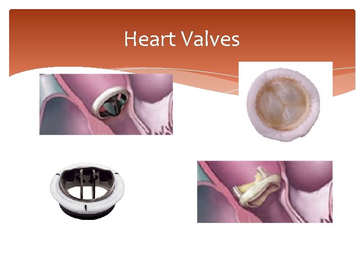 Heart Valves 