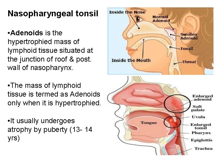 Nasopharyngeal tonsil • Adenoids is the hypertrophied mass of lymphoid tissue situated at the Nasopharyngeal tonsil • Adenoids is the hypertrophied mass of lymphoid tissue situated at the