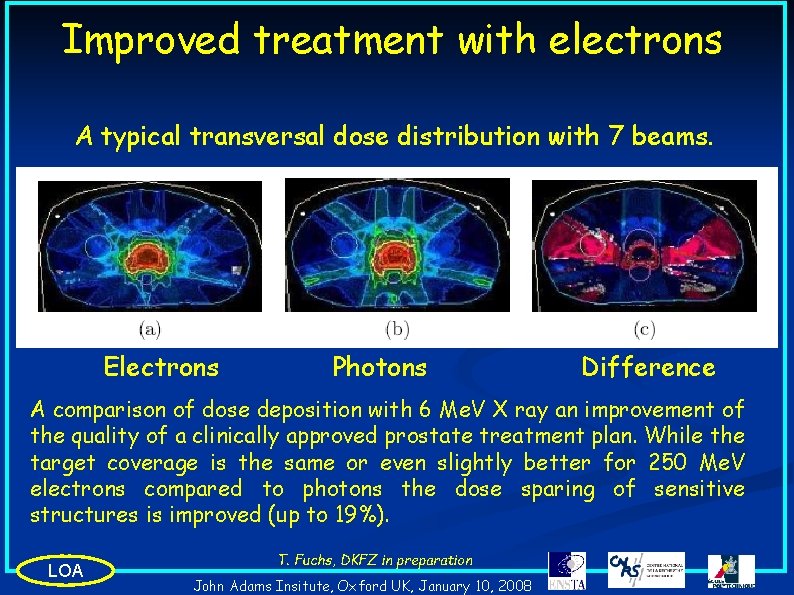 Improved treatment with electrons A typical transversal dose distribution with 7 beams. Electrons Photons