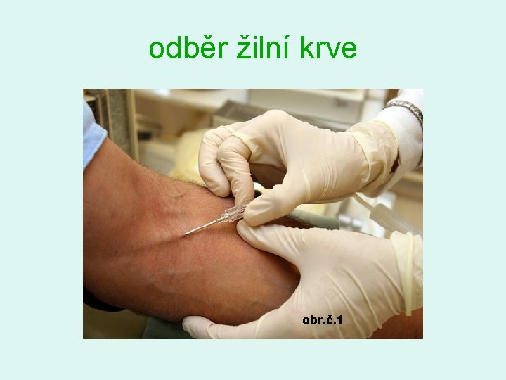 odběr žilní krve obr. č. 1 