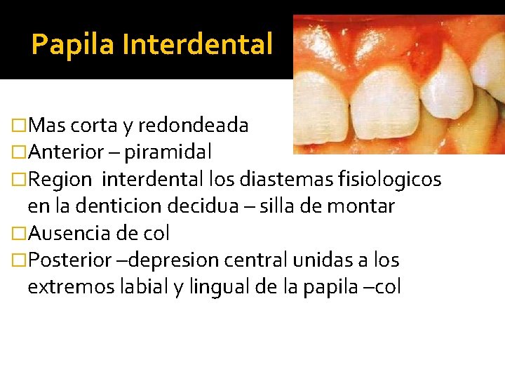 Papila Interdental �Mas corta y redondeada �Anterior – piramidal �Region interdental los diastemas fisiologicos