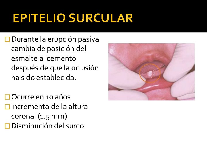 EPITELIO SURCULAR � Durante la erupción pasiva cambia de posición del esmalte al cemento