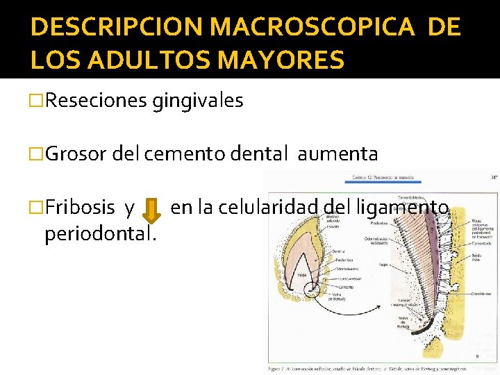 DESCRIPCION MACROSCOPICA DE LOS ADULTOS MAYORES �Reseciones gingivales �Grosor del cemento dental �Fribosis aumenta