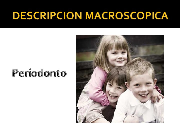 DESCRIPCION MACROSCOPICA Periodonto 