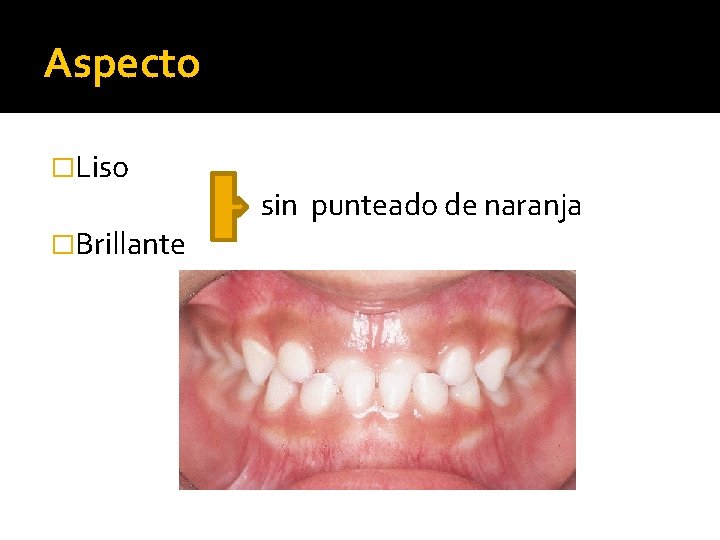 Aspecto �Liso �Brillante sin punteado de naranja 