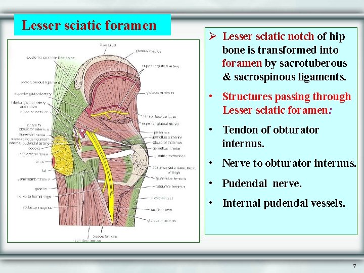 Lesser sciatic foramen Ø Lesser sciatic notch of hip bone is transformed into foramen