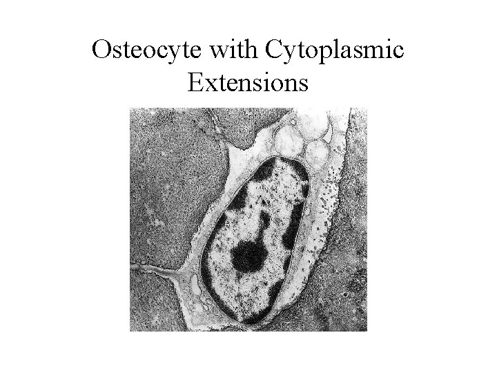 Osteocyte with Cytoplasmic Extensions 