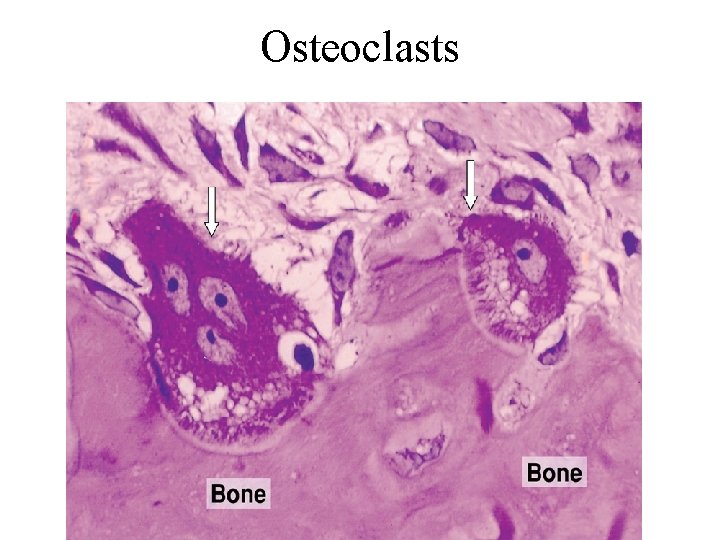 Osteoclasts 