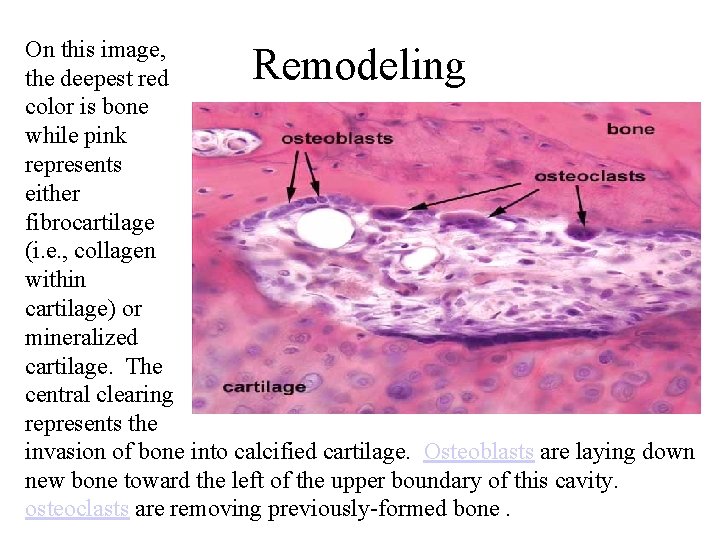 On this image, the deepest red color is bone while pink represents either fibrocartilage