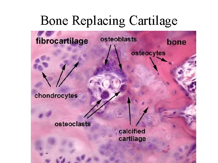 Bone Replacing Cartilage 