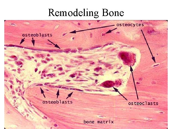 Remodeling Bone 