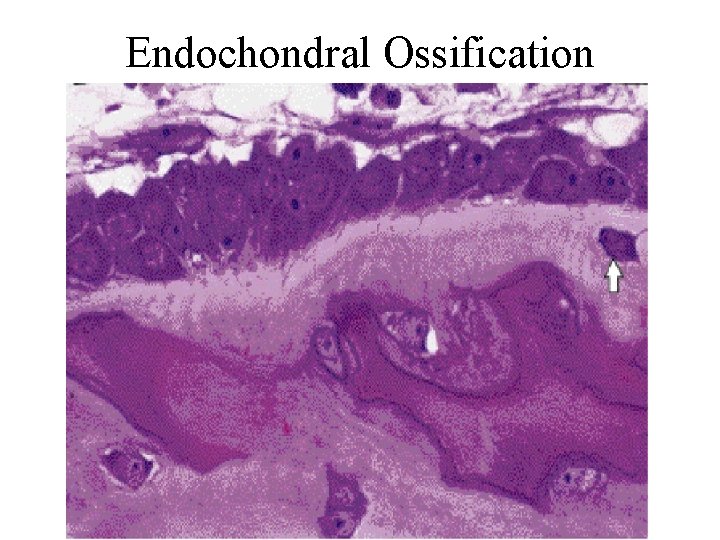 Endochondral Ossification 