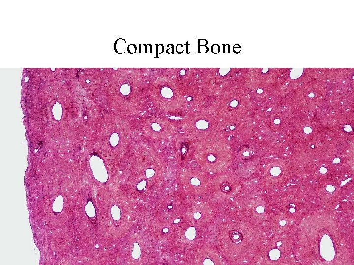 Compact Bone 