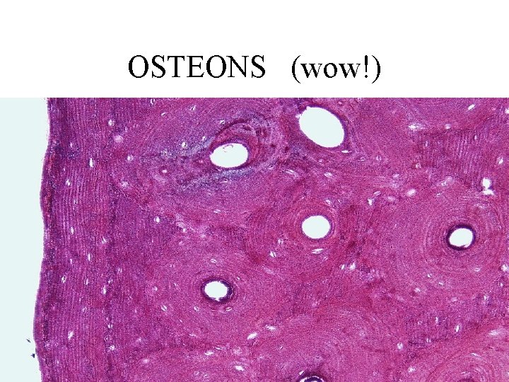 OSTEONS (wow!) 