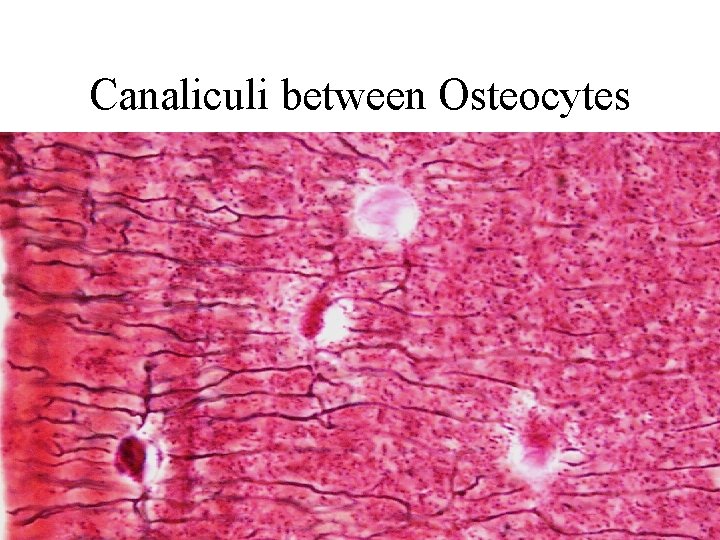 Canaliculi between Osteocytes 