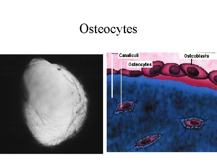 Osteocytes 