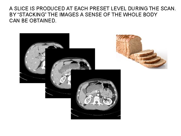 A SLICE IS PRODUCED AT EACH PRESET LEVEL DURING THE SCAN. BY “STACKING” THE