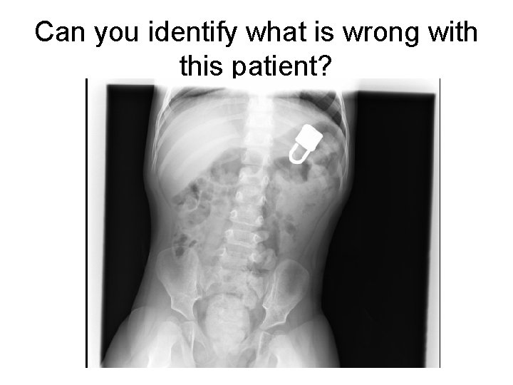 Can you identify what is wrong with this patient? 