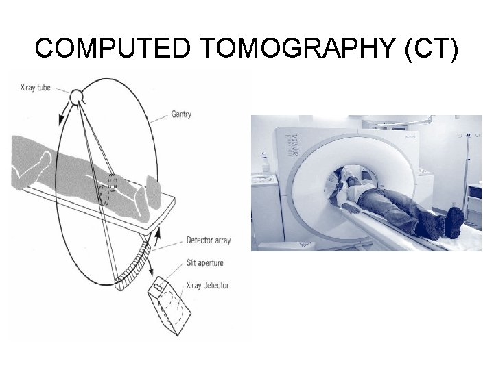 COMPUTED TOMOGRAPHY (CT) 