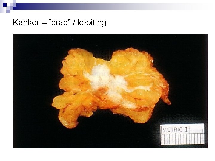 Kanker – “crab” / kepiting 