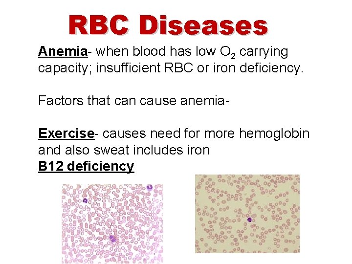 RBC Diseases Anemia- when blood has low O 2 carrying capacity; insufficient RBC or