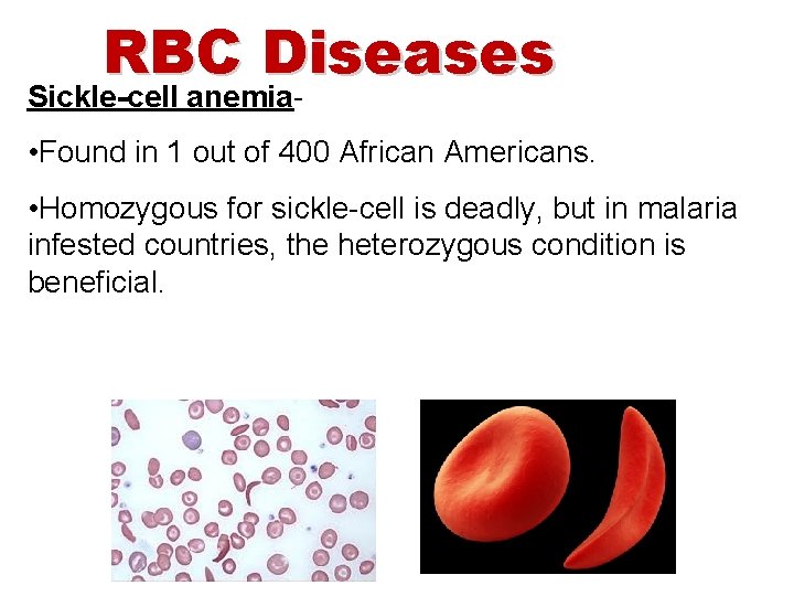 RBC Diseases Sickle-cell anemia- • Found in 1 out of 400 African Americans. •