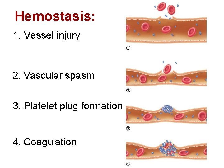 Hemostasis: 1. Vessel injury 2. Vascular spasm 3. Platelet plug formation 4. Coagulation 