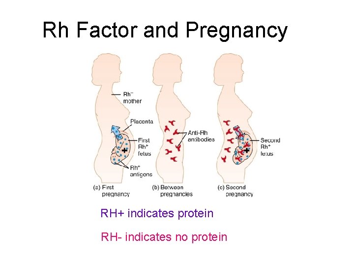 Rh Factor and Pregnancy RH+ indicates protein RH- indicates no protein 