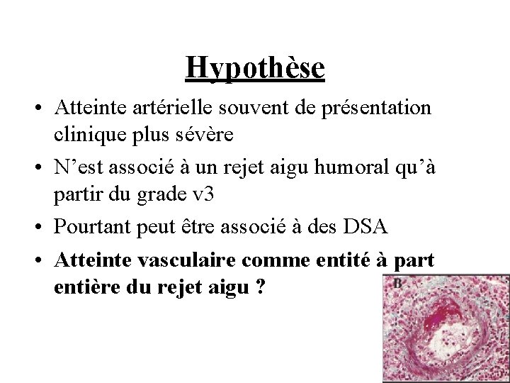 Hypothèse • Atteinte artérielle souvent de présentation clinique plus sévère • N’est associé à