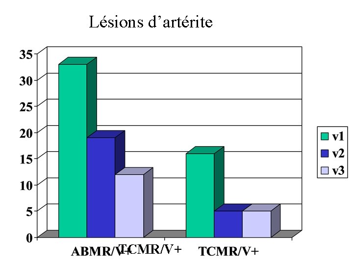 Lésions d’artérite TCMR/V+ 