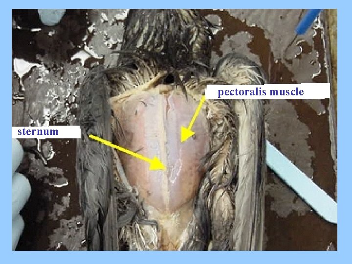 pectoralis muscle sternum dfds sdsd 