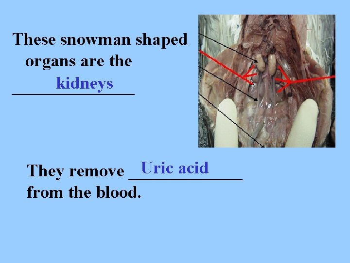These snowman shaped organs are the kidneys _______ Uric acid They remove _______ from