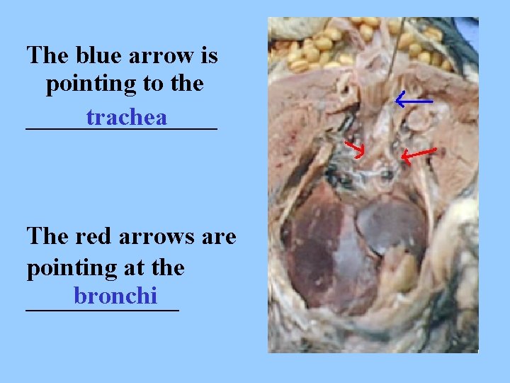 The blue arrow is pointing to the ________ trachea The red arrows are pointing