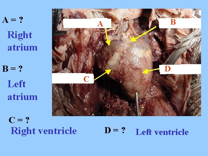A=? B A Right atrium B=? Left atrium C=? Right ventricle D C D=?