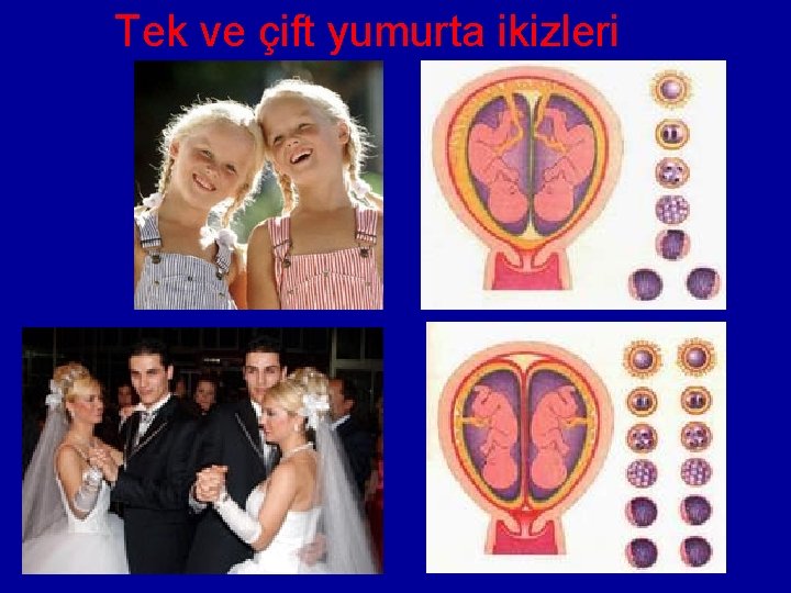 Tek ve çift yumurta ikizleri 