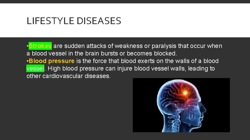 LIFESTYLE DISEASES • Strokes are sudden attacks of weakness or paralysis that occur when