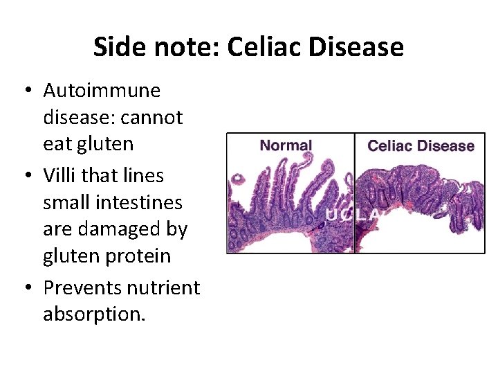 Side note: Celiac Disease • Autoimmune disease: cannot eat gluten • Villi that lines