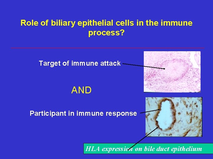 Role of biliary epithelial cells in the immune process? Target of immune attack AND Role of biliary epithelial cells in the immune process? Target of immune attack AND